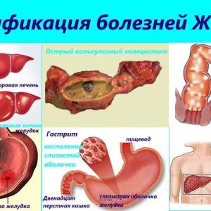 Заболевания пищеварительной системы